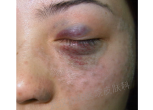 laser微博_candelalaser_laser