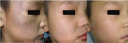 laser微博_laser_candelalaser