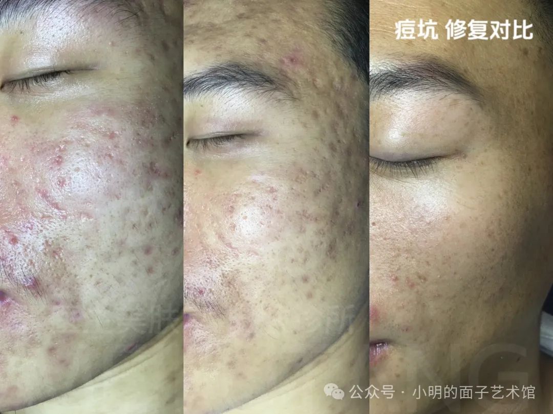 laser是什么意思_laserjet_laser