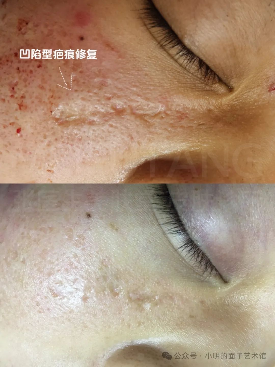 laser是什么意思_laserjet_laser