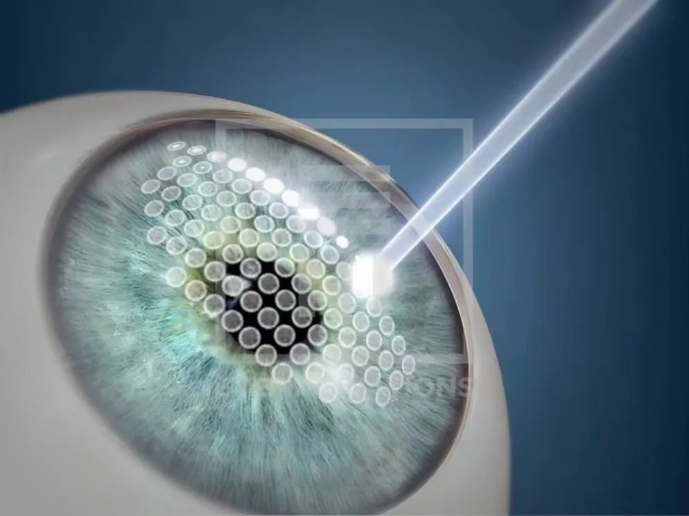 laser_laser虚拟男团_laser是什么意思