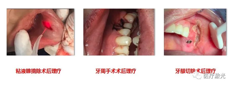 laser_laser虚拟男团_laser是什么意思