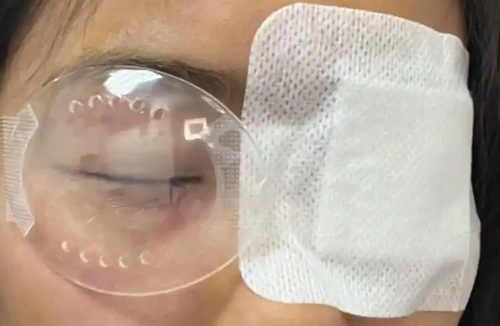 近视激光手术费用_laser_全飞秒激光手术价格