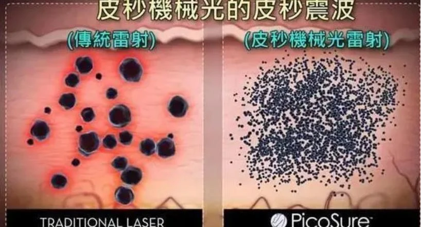 laser_laser虚拟男团_laser是什么意思