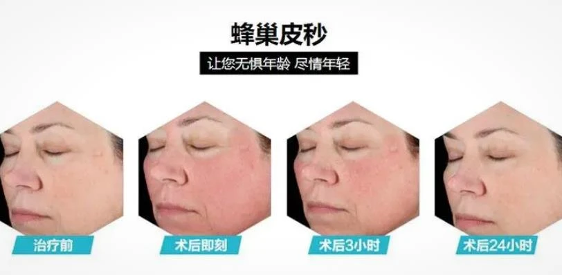 laser_laser虚拟男团_laser是什么意思