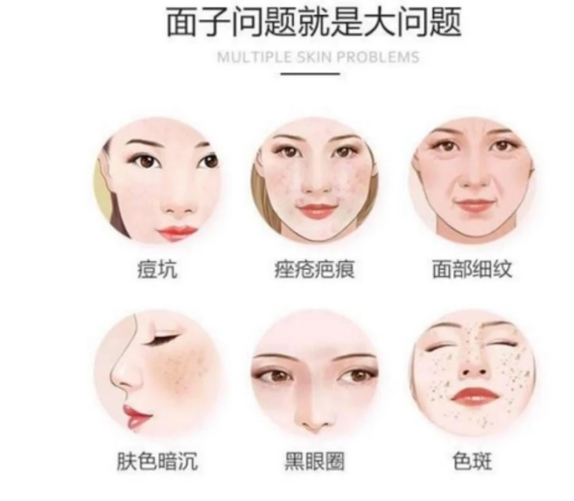 laser虚拟男团_laser是什么意思_laser