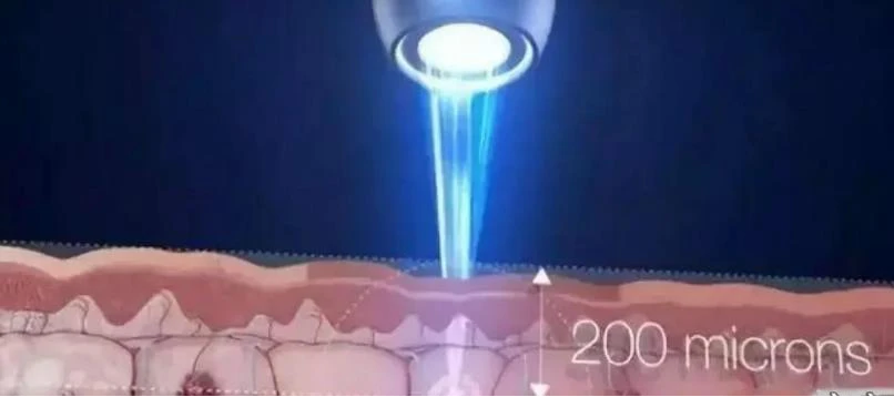 laser是什么意思_laser虚拟男团_laser