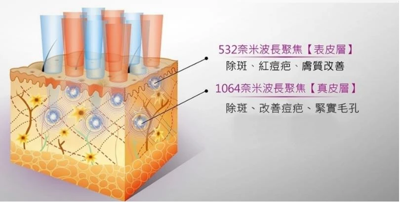 laser_laser虚拟男团_laser是什么意思