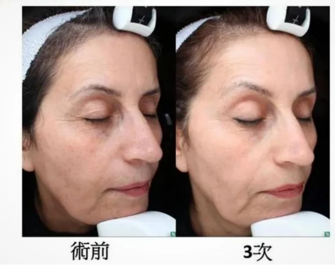 laser_laser是什么意思_laser虚拟男团
