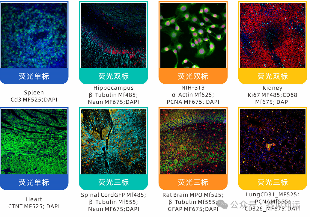 laser是什么意思_laser男团_laser