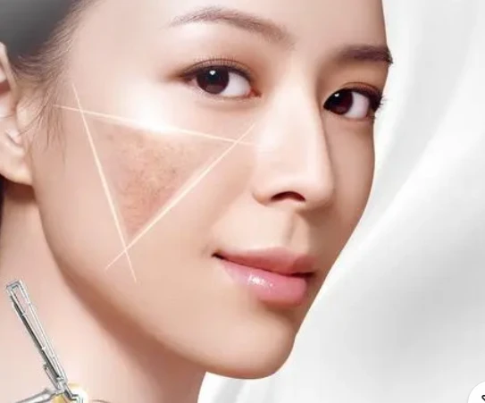 laser男团_laser_laser是什么意思