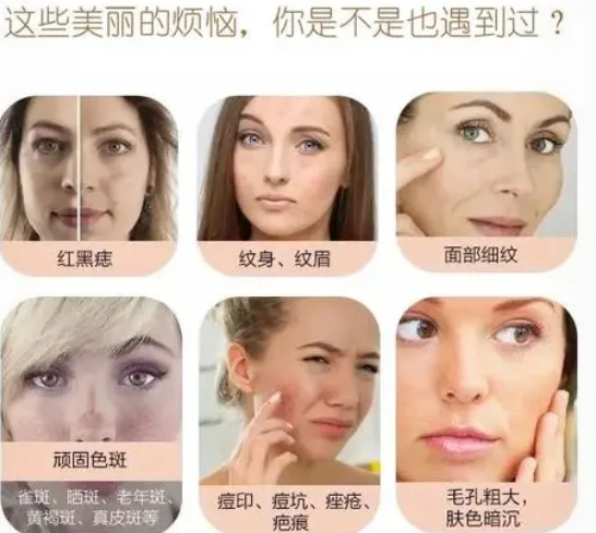 laser是什么意思_laser_laser男团